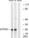 ATP synthase subunit d, mitochondrial antibody, LS-B9712, Lifespan Biosciences, Western Blot image 