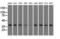 3-Hydroxyisobutyryl-CoA Hydrolase antibody, LS-B9997, Lifespan Biosciences, Western Blot image 