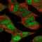 Cyclin Dependent Kinase 5 antibody, HPA064535, Atlas Antibodies, Immunofluorescence image 