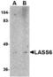 Ceramide Synthase 6 antibody, TA306689, Origene, Western Blot image 