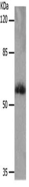 Monocarboxylate transporter 5 antibody, CSB-PA968241, Cusabio, Western Blot image 
