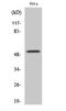 G3BP Stress Granule Assembly Factor 2 antibody, STJ93174, St John