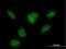 R3H Domain Containing 2 antibody, H00022864-B01P, Novus Biologicals, Immunocytochemistry image 