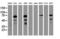 Receptor Interacting Serine/Threonine Kinase 1 antibody, LS-C175255, Lifespan Biosciences, Western Blot image 