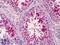 Solute Carrier Family 35 Member D1 antibody, LS-B4978, Lifespan Biosciences, Immunohistochemistry paraffin image 