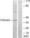 Tyrosine 3-Monooxygenase/Tryptophan 5-Monooxygenase Activation Protein Eta antibody, LS-C119361, Lifespan Biosciences, Western Blot image 