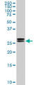 High Mobility Group Box 2 antibody, LS-C104971, Lifespan Biosciences, Western Blot image 