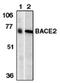 Beta-Secretase 2 antibody, AP05097PU-N, Origene, Western Blot image 