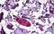 Diacylglycerol O-acyltransferase 1 antibody, GTX89164, GeneTex, Immunohistochemistry paraffin image 