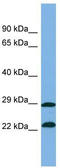 Zinc Finger Protein 563 antibody, TA344423, Origene, Western Blot image 