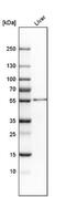 Aldehyde Dehydrogenase 2 Family Member antibody, NBP2-14280, Novus Biologicals, Western Blot image 