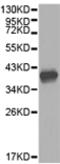 Hydroxymethylbilane Synthase antibody, TA321079, Origene, Western Blot image 