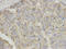 Carnitine Palmitoyltransferase 1A antibody, LS-C333970, Lifespan Biosciences, Immunohistochemistry frozen image 