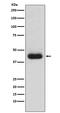 CD82 Molecule antibody, M02300, Boster Biological Technology, Western Blot image 