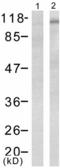 Protein Tyrosine Kinase 2 Beta antibody, TA321622, Origene, Western Blot image 