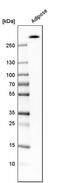 Acetyl-CoA carboxylase 2 antibody, PA5-52309, Invitrogen Antibodies, Western Blot image 