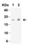 Claudin 1 antibody, 5187, ProSci, Western Blot image 