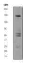 Synaptic Ras GTPase Activating Protein 1 antibody, ab77235, Abcam, Western Blot image 