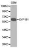 Cytochrome P450 Family 1 Subfamily B Member 1 antibody, PA5-76035, Invitrogen Antibodies, Western Blot image 