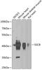 Sarcoglycan Beta antibody, GTX55795, GeneTex, Western Blot image 