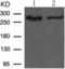 Acetyl-CoA Carboxylase Alpha antibody, TA321969, Origene, Western Blot image 