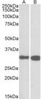 Unc-13 Homolog B antibody, 42-327, ProSci, Enzyme Linked Immunosorbent Assay image 