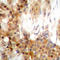 Akt antibody, LS-C358908, Lifespan Biosciences, Immunohistochemistry paraffin image 