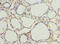 CMC4 antibody, orb28195, Biorbyt, Immunohistochemistry paraffin image 