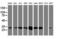 N-Ribosyldihydronicotinamide:Quinone Reductase 2 antibody, M03112-1, Boster Biological Technology, Western Blot image 