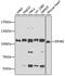EPH Receptor B2 antibody, GTX57740, GeneTex, Western Blot image 