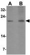 Lysozyme Like 1 antibody, GTX32083, GeneTex, Western Blot image 