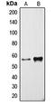 Cytochrome P450 Family 3 Subfamily A Member 4 antibody, orb213828, Biorbyt, Western Blot image 