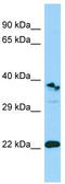 Triggering Receptor Expressed On Myeloid Cells Like 1 antibody, TA337742, Origene, Western Blot image 