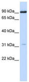 Cholinergic Receptor Nicotinic Alpha 4 Subunit antibody, TA330422, Origene, Western Blot image 