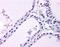 Lysophosphatidylcholine Acyltransferase 1 antibody, 51-263, ProSci, Immunohistochemistry frozen image 