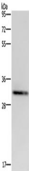 Intercellular Adhesion Molecule 4 (Landsteiner-Wiener Blood Group) antibody, TA350075, Origene, Western Blot image 