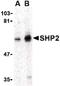 Protein Tyrosine Phosphatase Non-Receptor Type 11 antibody, PA5-20279, Invitrogen Antibodies, Western Blot image 