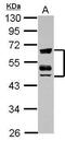 Zinc finger FYVE domain-containing protein 19 antibody, PA5-30856, Invitrogen Antibodies, Western Blot image 
