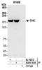 Clathrin Heavy Chain antibody, A304-743A, Bethyl Labs, Immunoprecipitation image 