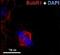 Mitotic checkpoint serine/threonine-protein kinase BUB1 beta antibody, ab54894, Abcam, Immunocytochemistry image 