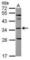 Sterol Carrier Protein 2 antibody, GTX107339, GeneTex, Western Blot image 