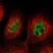Small Integral Membrane Protein 20 antibody, NBP1-90943, Novus Biologicals, Immunocytochemistry image 