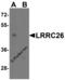 Leucine Rich Repeat Containing 26 antibody, 7539, ProSci, Western Blot image 