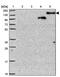 CCR4-NOT Transcription Complex Subunit 1 antibody, PA5-62024, Invitrogen Antibodies, Western Blot image 