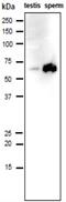 Izumo Sperm-Egg Fusion 1 antibody, GTX00689, GeneTex, Western Blot image 