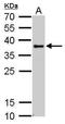 Uncoupling Protein 3 antibody, GTX112699, GeneTex, Western Blot image 