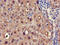 PSP1 antibody, LS-C395908, Lifespan Biosciences, Immunohistochemistry paraffin image 