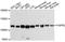 Fibroblast growth factor receptor 2 antibody, LS-C747539, Lifespan Biosciences, Western Blot image 