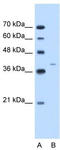 HMW Cytokeratin antibody, TA346321, Origene, Western Blot image 