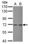 Zinc Finger SWIM-Type Containing 2 antibody, NBP2-21055, Novus Biologicals, Western Blot image 
